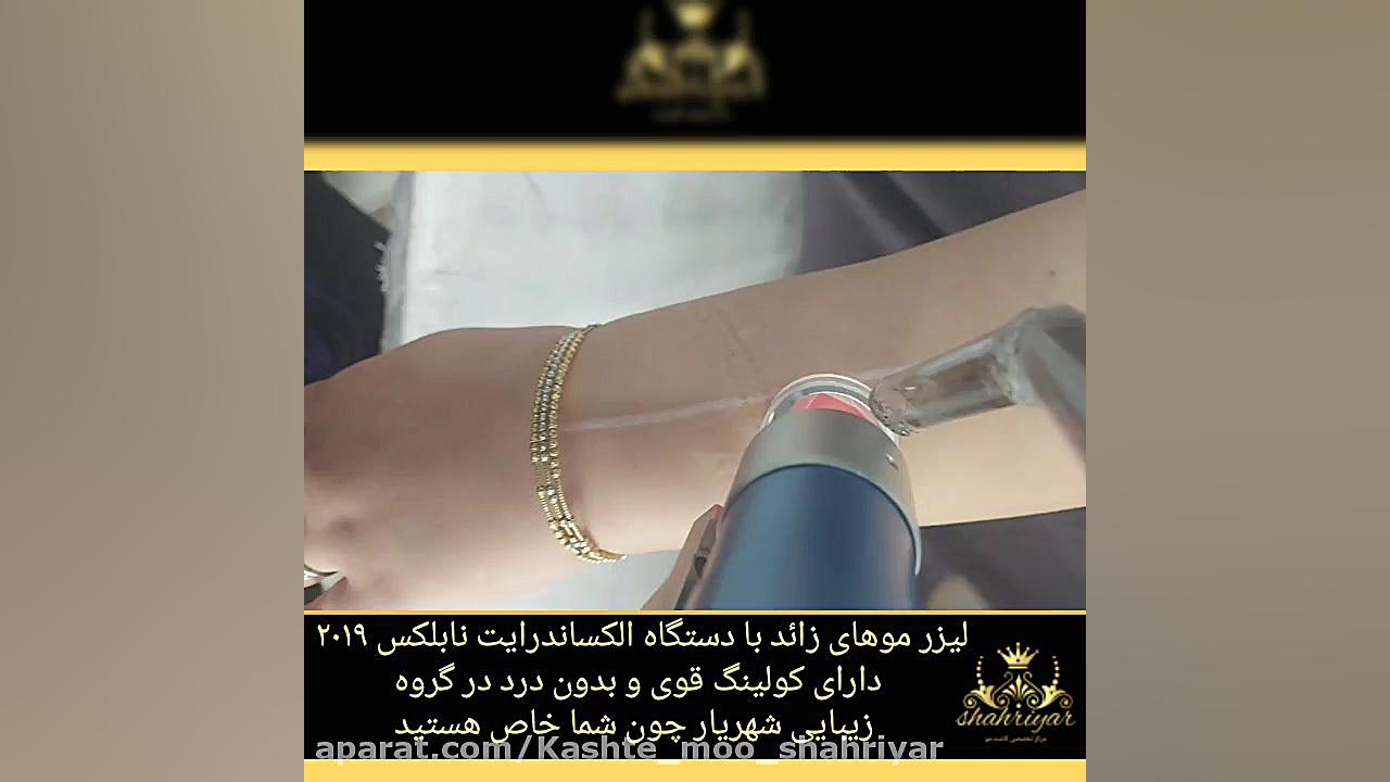 لیزر موهای زائد با دستگاه الکس...