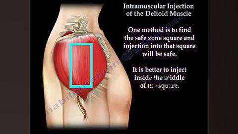 نحوه تزریق آمپول به بازو