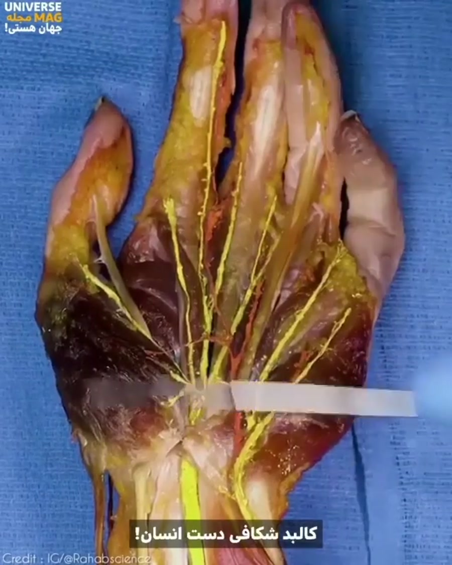 کالبد شکافی دست انسان ...فوق ا...