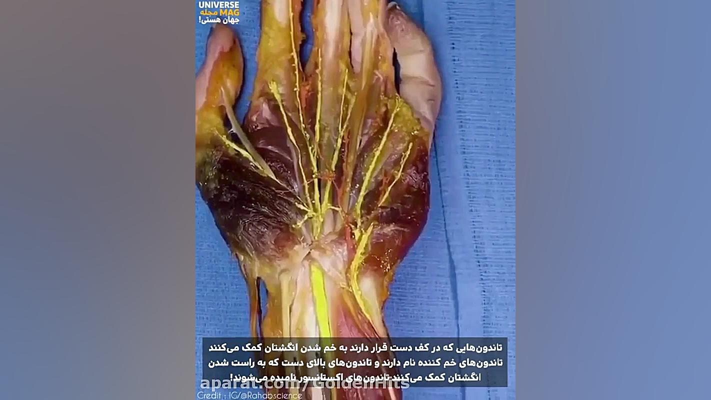 کالبد شکافی دست انسان ...فوق ا...