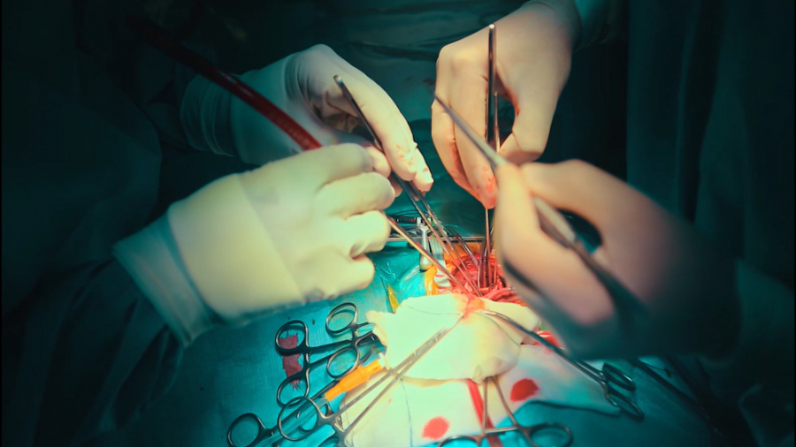 کم سابقه ترین جراحی قلب باز کو...