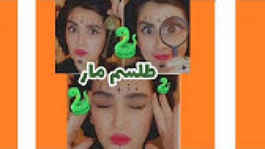 حل تمامی مشکلات تضمینی توسط دع...