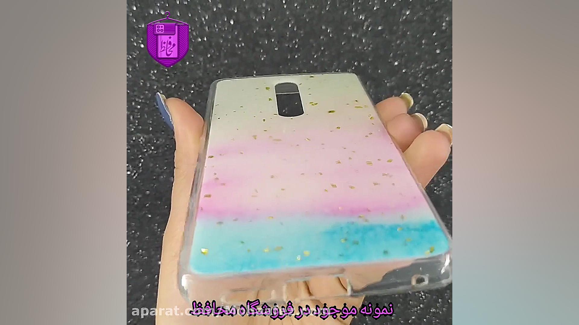 قاب فانتزی شیائومی کد XM281G