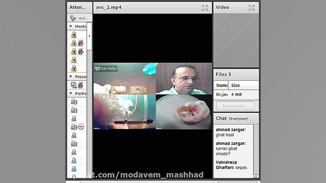 آماده سازی کانال ریشه در اندود...