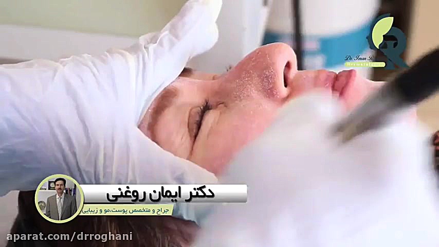 فیلم پاکسازی پوست صورت با میکر...