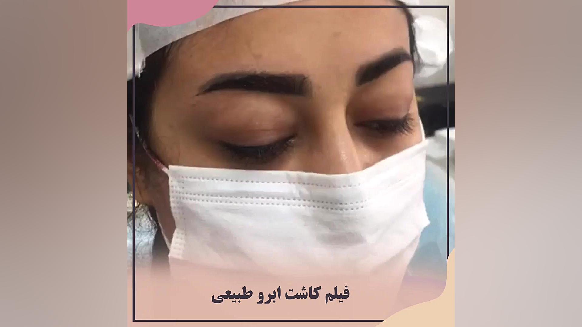 ویدیو کاشت ابرو پهن با طرح دلخ...