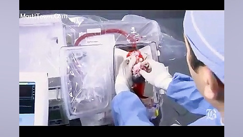 فعالیت طبیعی قلب بیرون بدن درو...