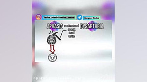 افازی و دیزارتی
