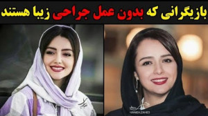 بازیگرانی که بدون عمل جراحی زی...