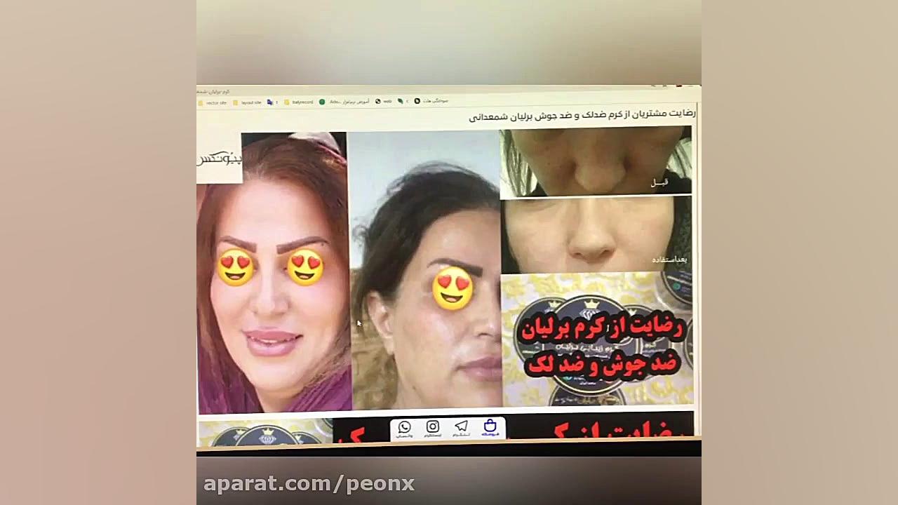 رضایت از کرم ضدلک و ضد جوش برل...