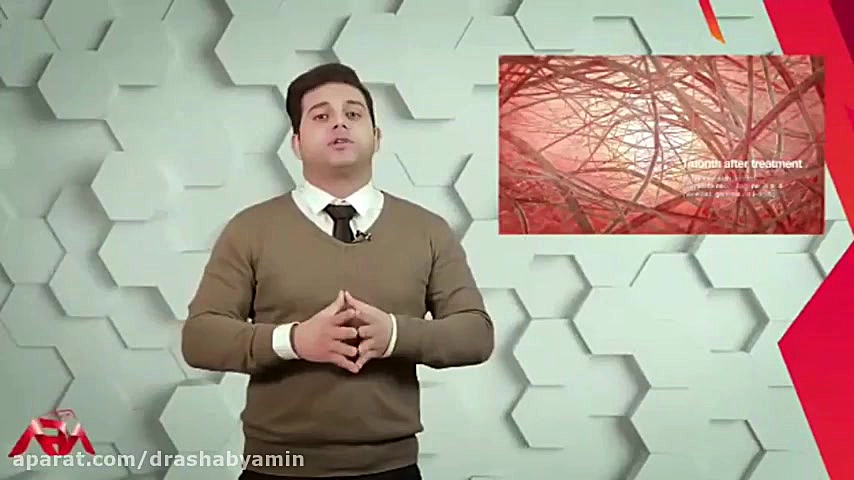 آر اف فرکشنال از زبان دکتر اصح...