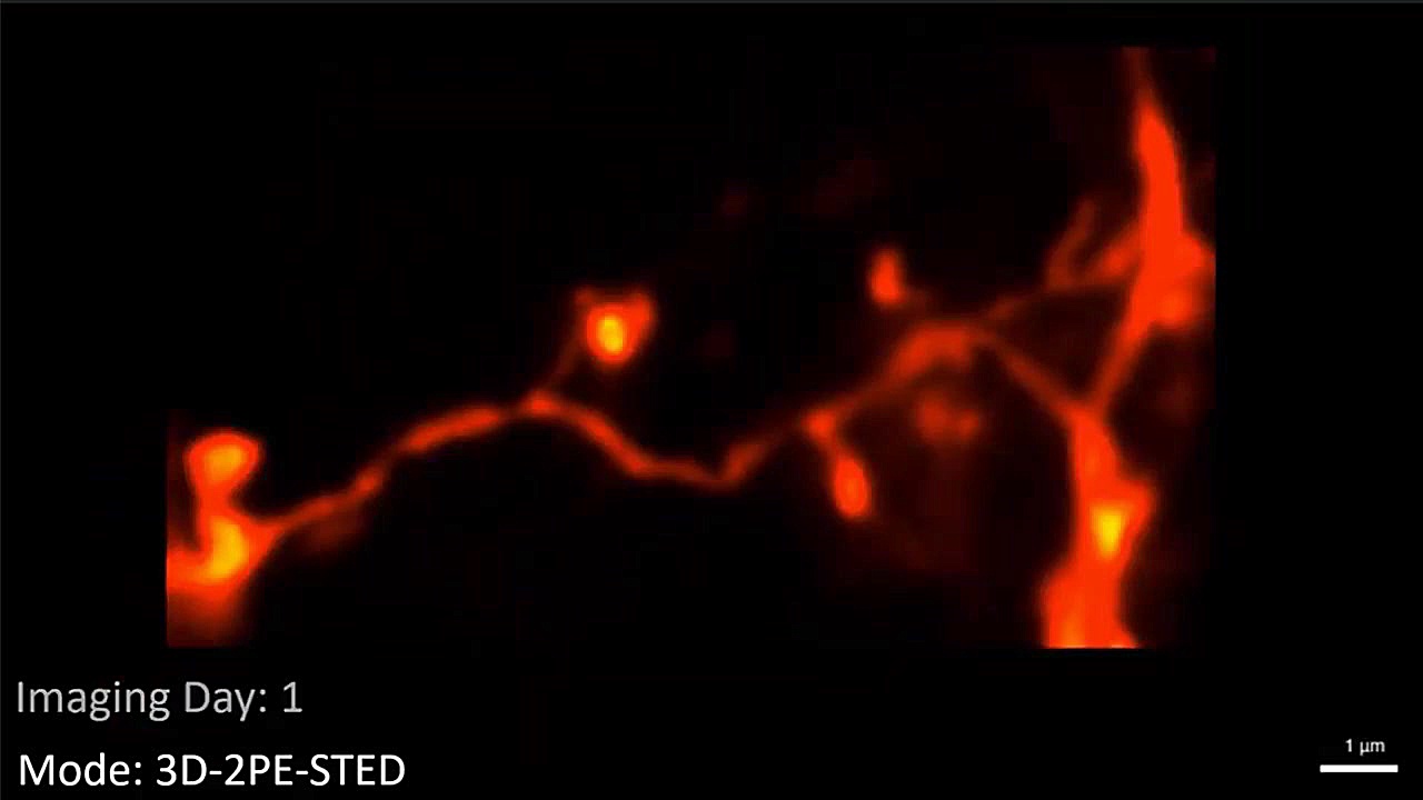 محققان از ساختار مغز موش زنده...