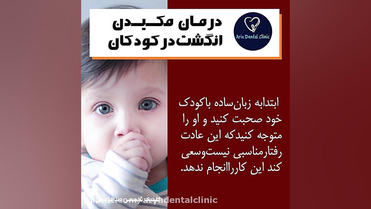 درمان مکیدن انگشت در کودکان