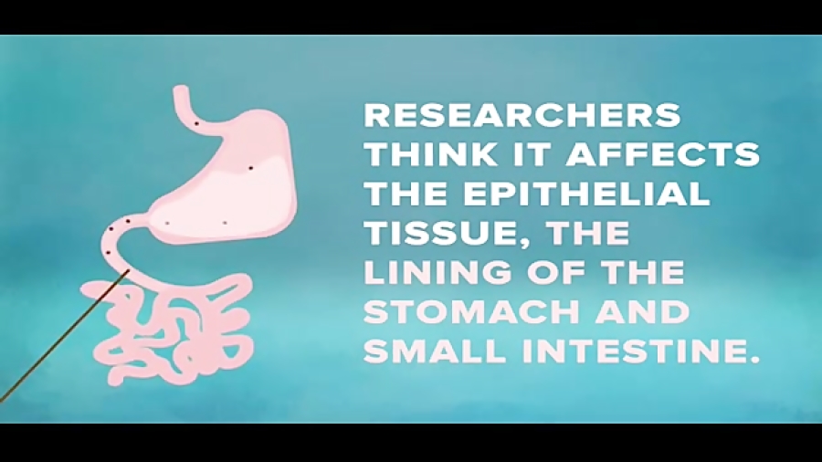 دوستی دیرینه قهوه و مدفوع