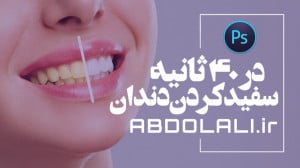 سفید کردن دندان در 40 ثانیه با...