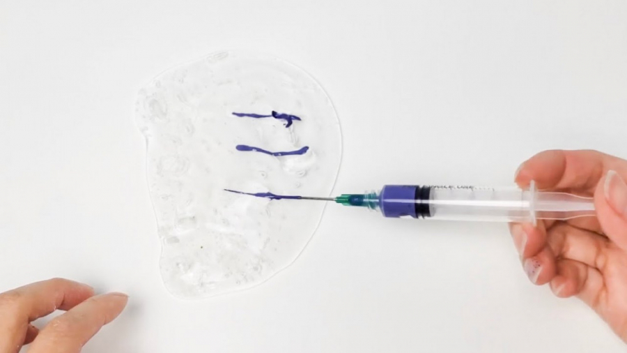 تزریق رنگ و میکاپ اکلیلی در اس...