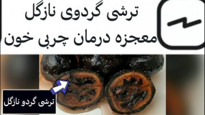 طرز تهیه ترشی گردوی نازگل (معج...