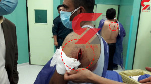 حمله وحشیانه 2 قاچاقچی چوب به...