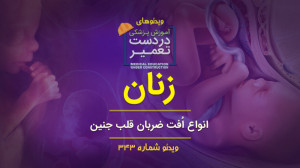 زنان (انواع اُفت ضربان قلب جنی...