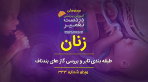زنان (طبقه بندی تایر و بررسی گ...