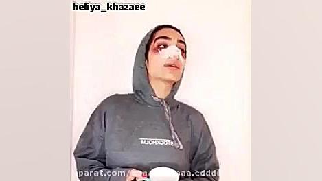 مشکلات بینی عملی ها..............