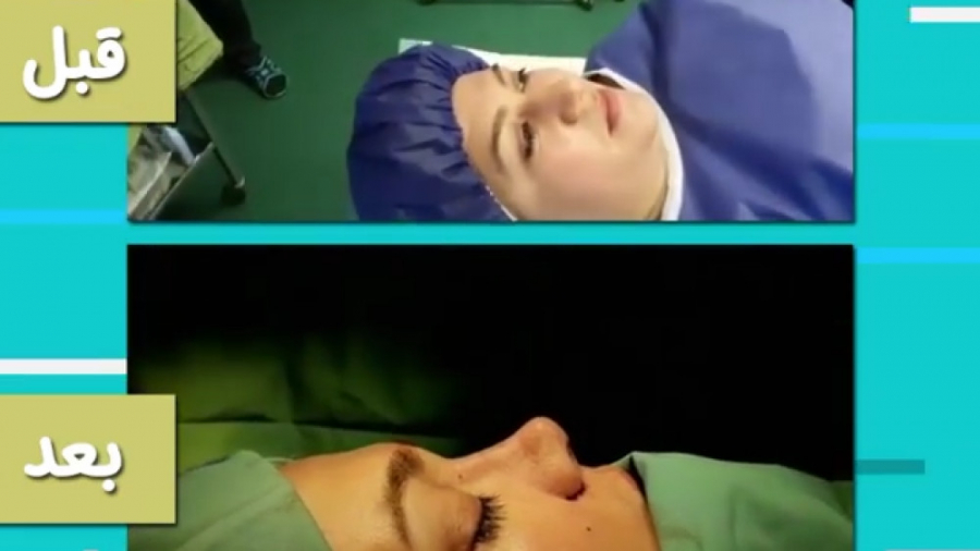 فیلم واقعی عمل بینی گوشتی