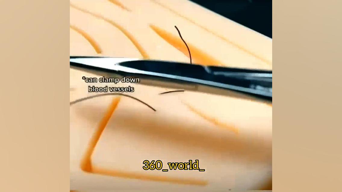 آموزش بخیه زدن