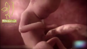 رابطه جنسی در بارداری