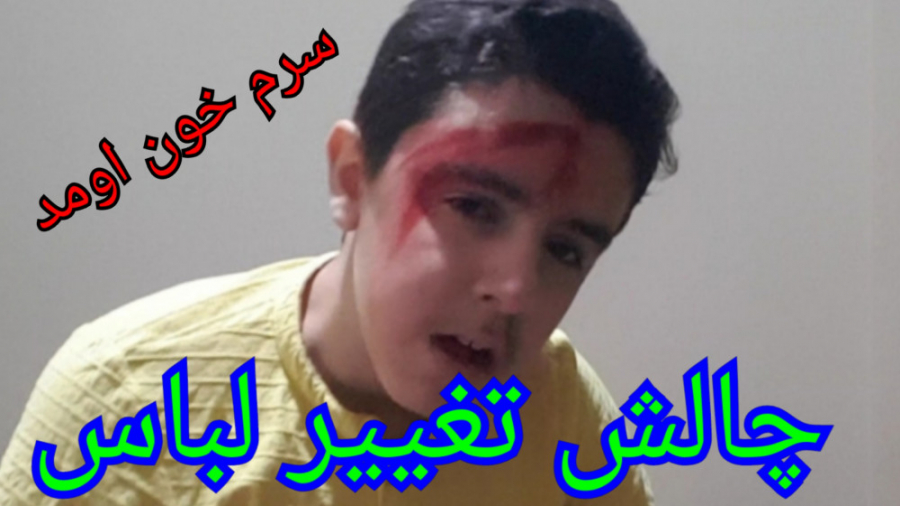 سَرَم خون اومد!!! چالش تغییر ل...