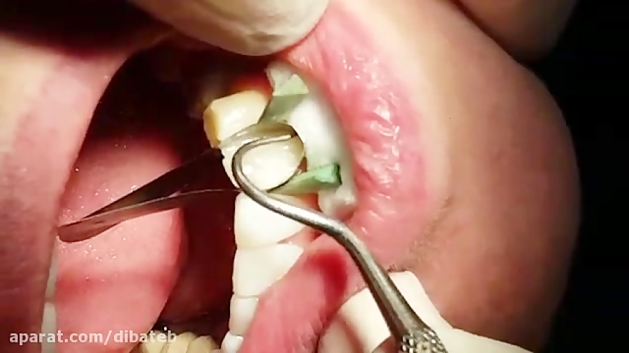 استاد دکتر علی یزدانی: پک کردن...