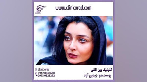 ساره بیات پف چشم و افتادگی چشم...