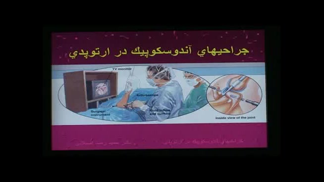 جراحی آندوسكوپیك در ارتوپدی