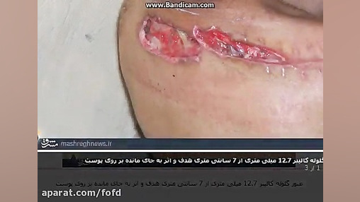 گلوله تک تیرانداز ایرانی صیاد...