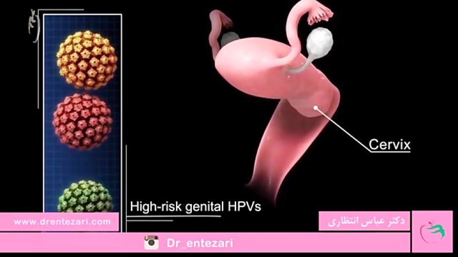 زگیل تناسلی چیست؟