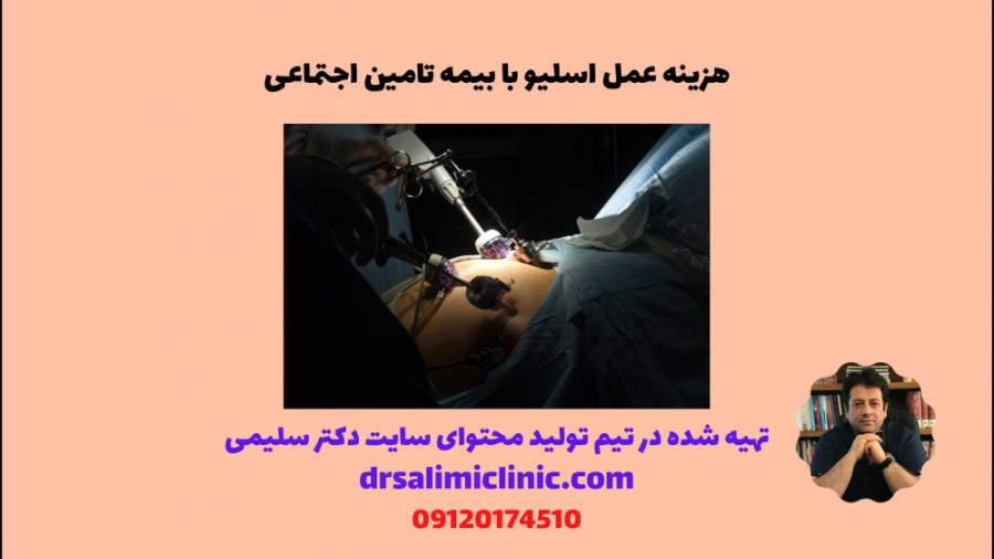 هزینه عمل اسلیو با بیمه تامین...