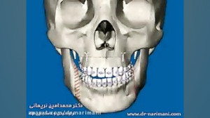 انحراف فک و ارتودنسی و جراحی ف...