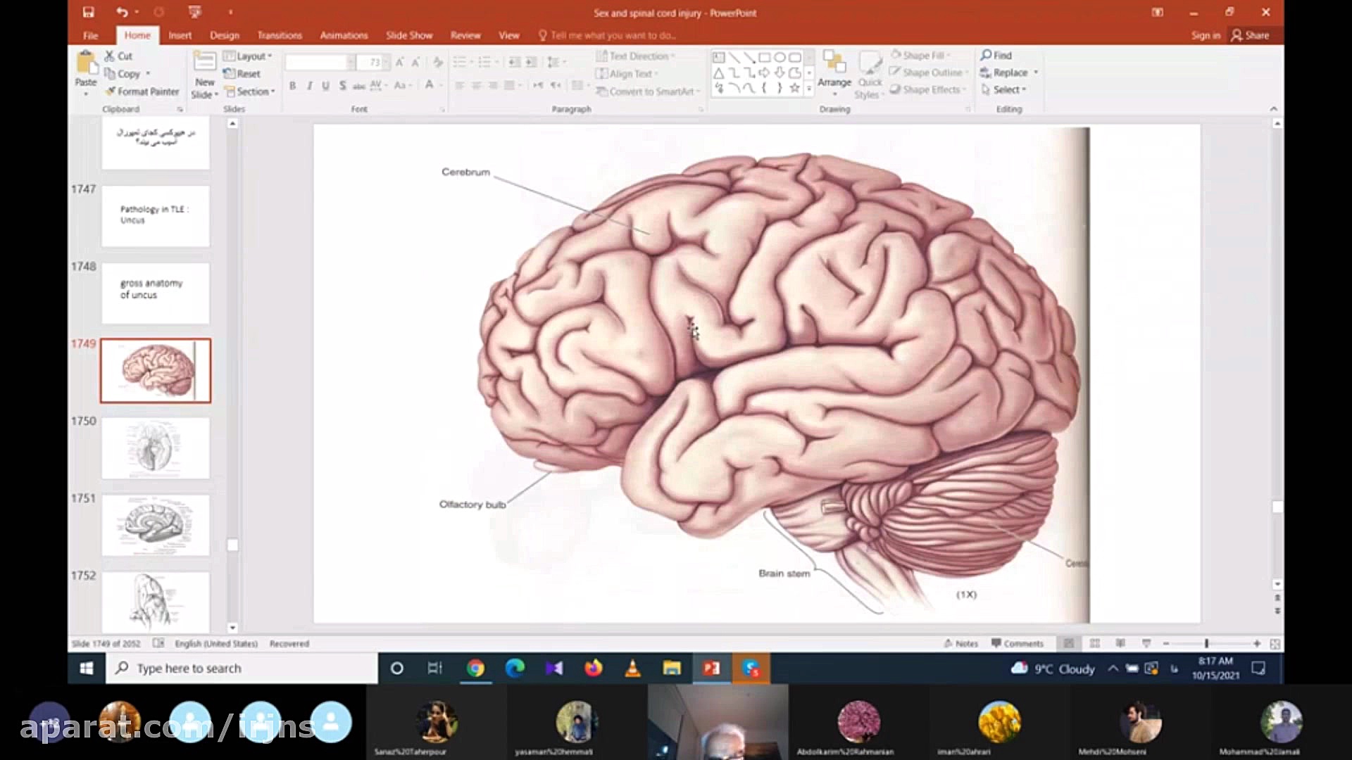 Temporal lobe epilepsy and ingenuity