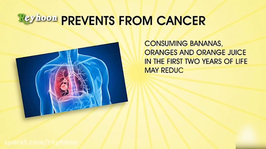 5 خاصیت درمانی موز