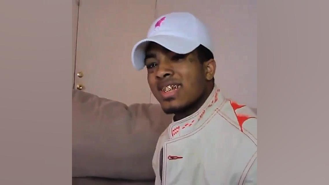 دندان تنتاسیون تلاست