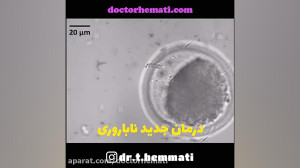 درمان جدید ناباروری