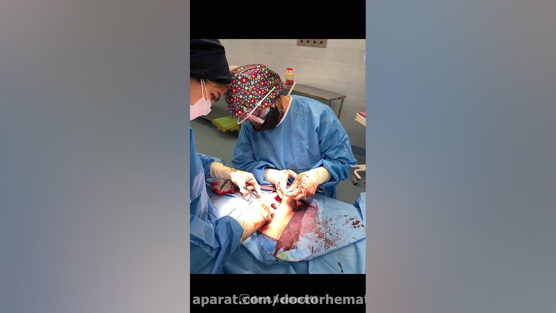 عمل میومکتومی