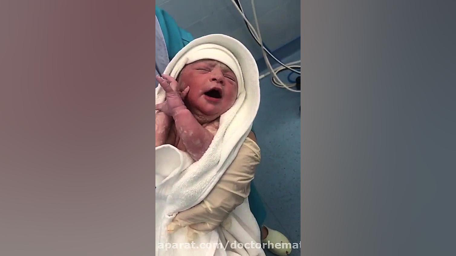 فیلم عمل کامل سزارین در اتاق ع...