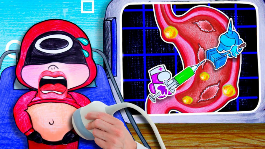 ایده های درمان سرباز اسکوید گی...