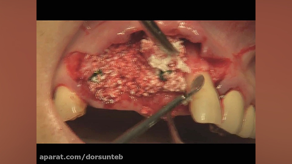 Total Solution for G.B.R 2