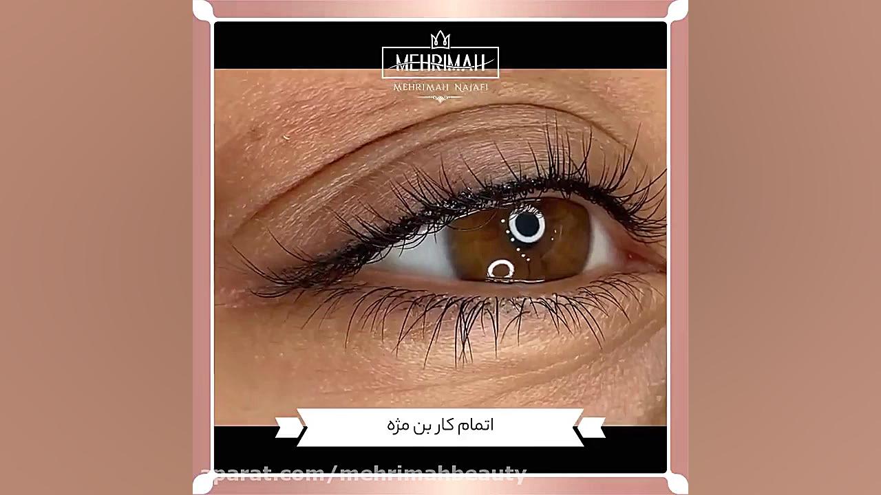 نمونه کار بن مژه