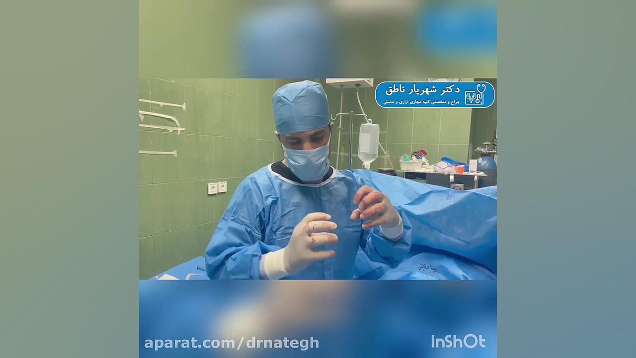 درمان کجی الت تناسلی در مردان