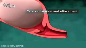 نحوه ی بدنیا آمدن نوزاد در زای...