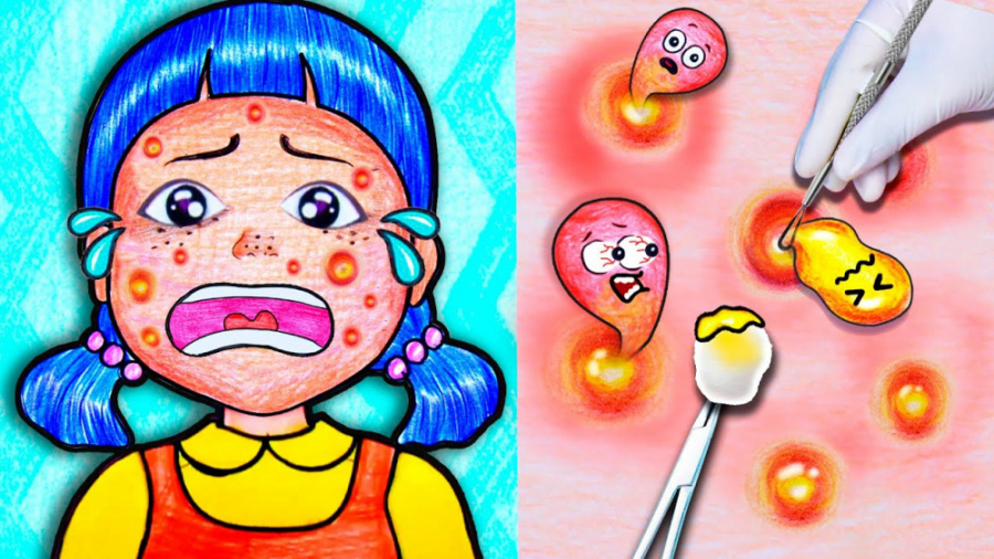 چالش اسکویید گیم  رفع مشکلات ج...