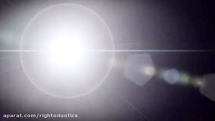 اصلاح دندان دراكولایی با ارتود...