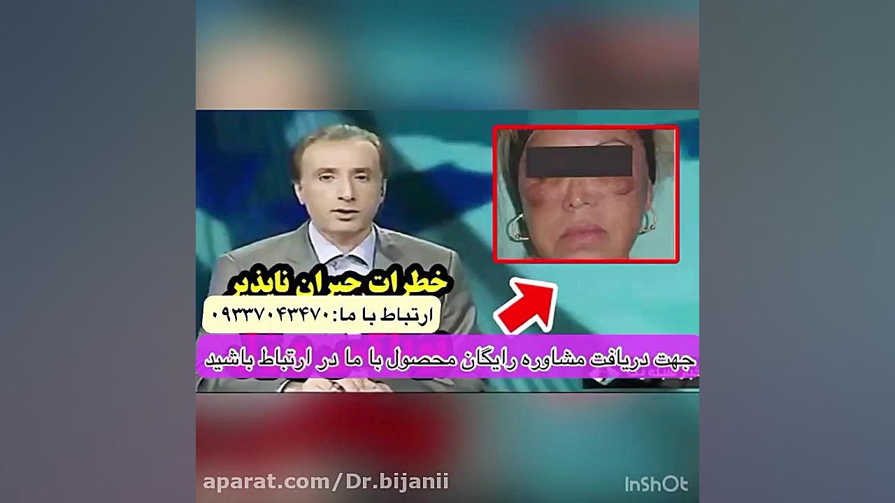 درمان چین &zwnj;&zwnj;چروک صور...